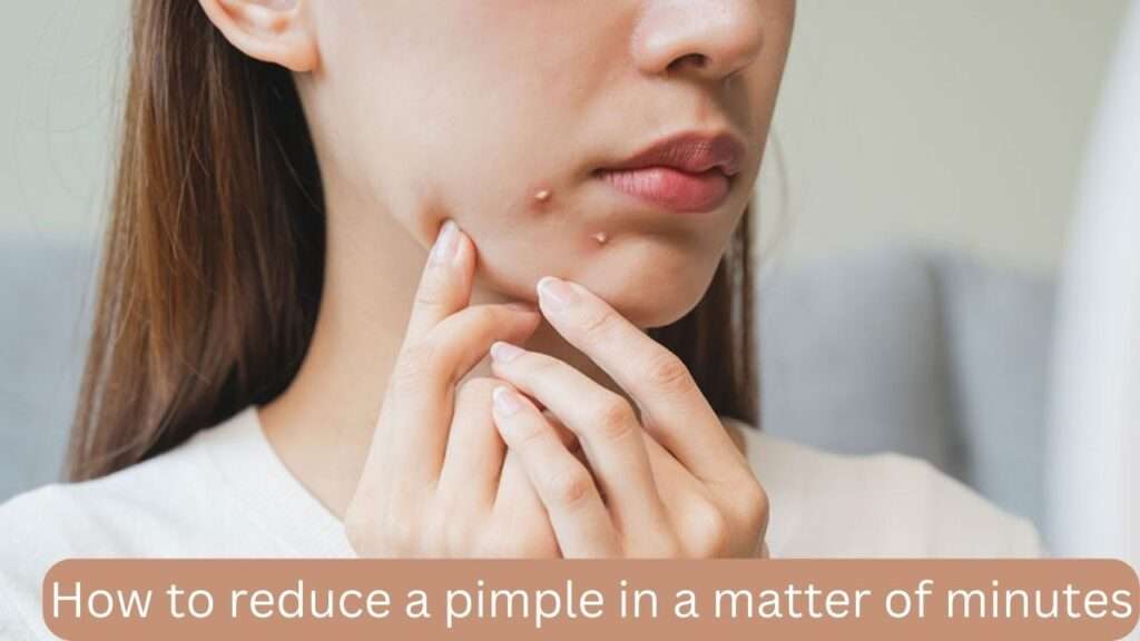 How to reduce a pimple in a matter of minutes